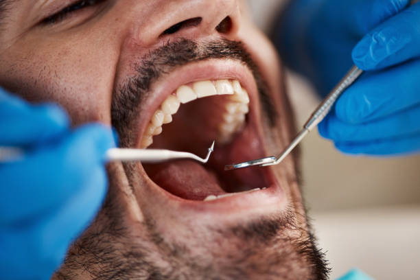Oral Surgery in Palouse, WA